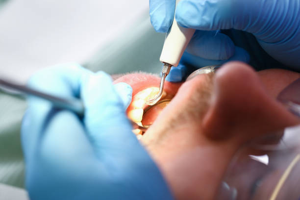 Best Emergency Denture Repair in Howard, WI